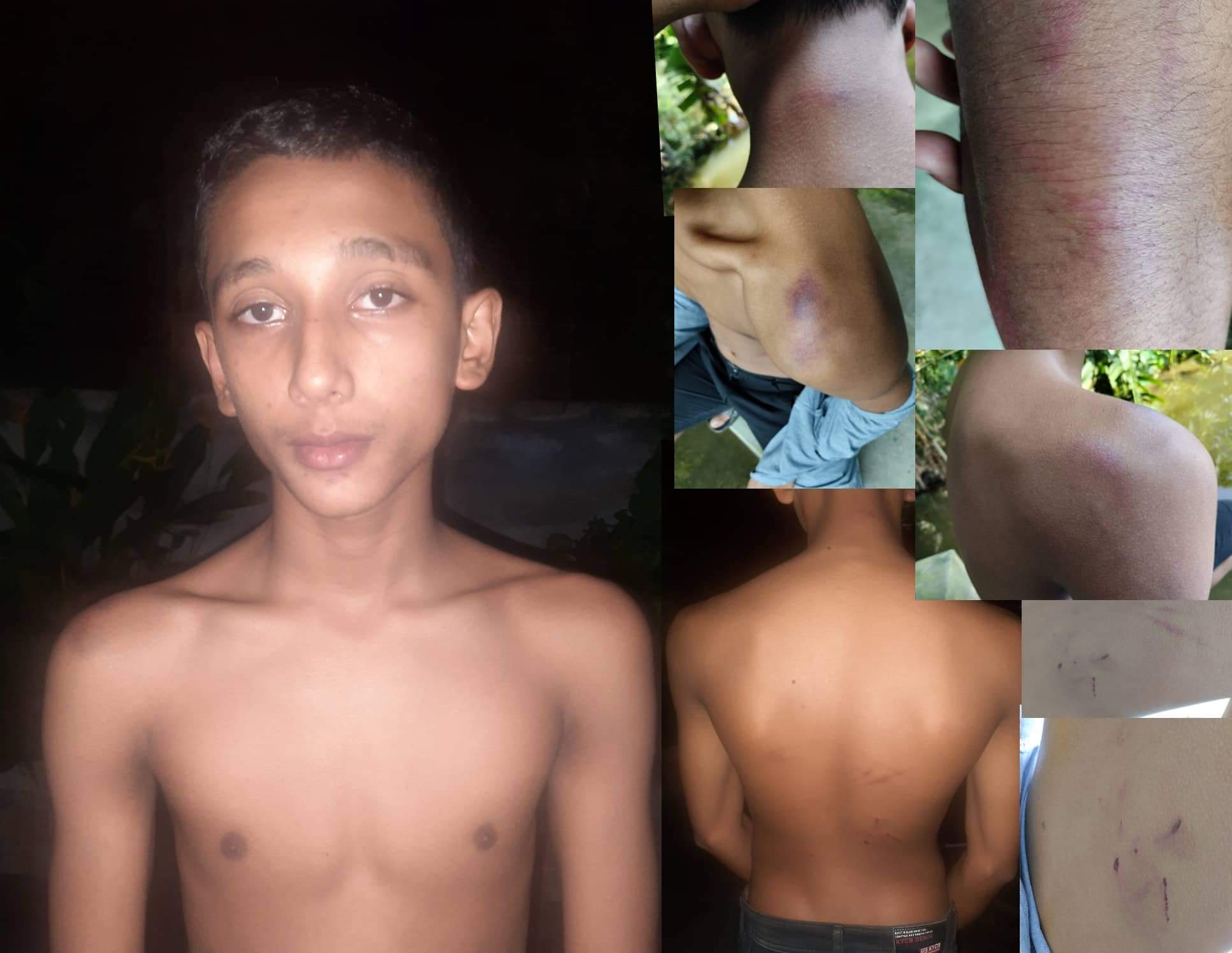 রামগঞ্জে স্কুল ছাত্রকে পিটিয়ে জখম সমঝোতার চেষ্টা কাউন্সিলরের