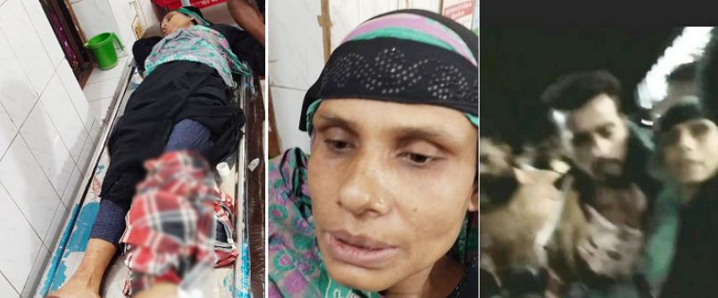 বরিশালে যাত্রীদের মধ্যে হুড়োহুড়ি, লঞ্চ-পন্টুনের মাঝে চাপা পড়ে নারীর পা বিচ্ছিন্ন