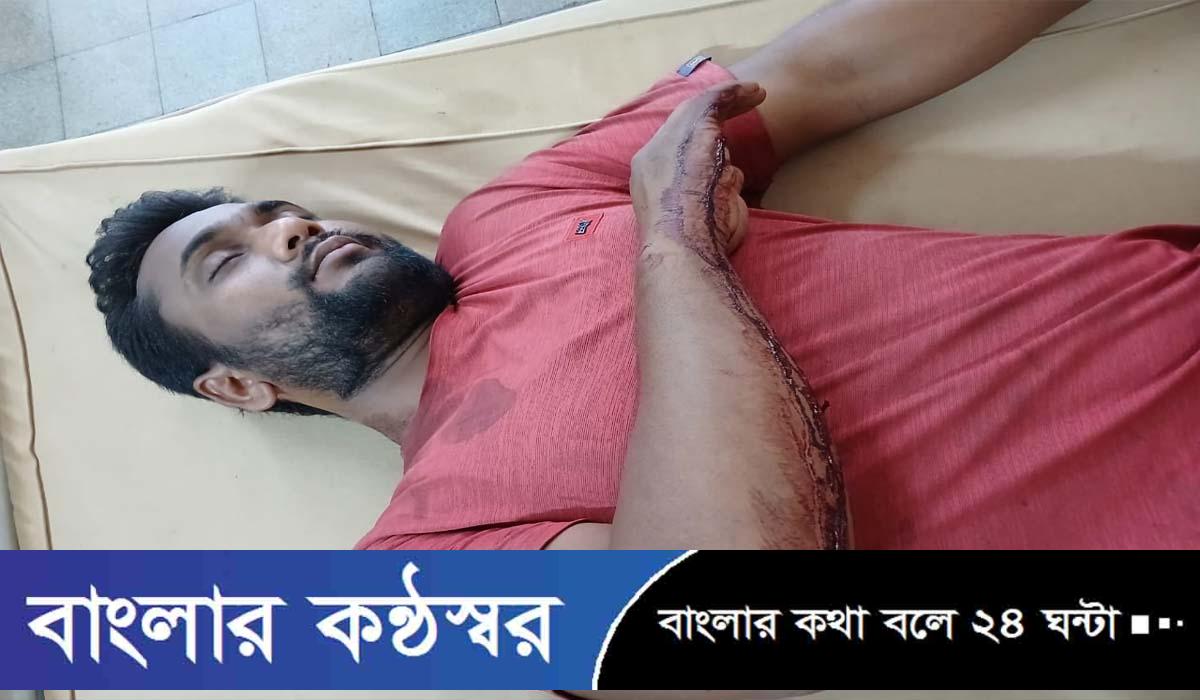 বরিশালে পূর্ব শত্রুতার জেরে যুবককে কুপিয়ে জখম