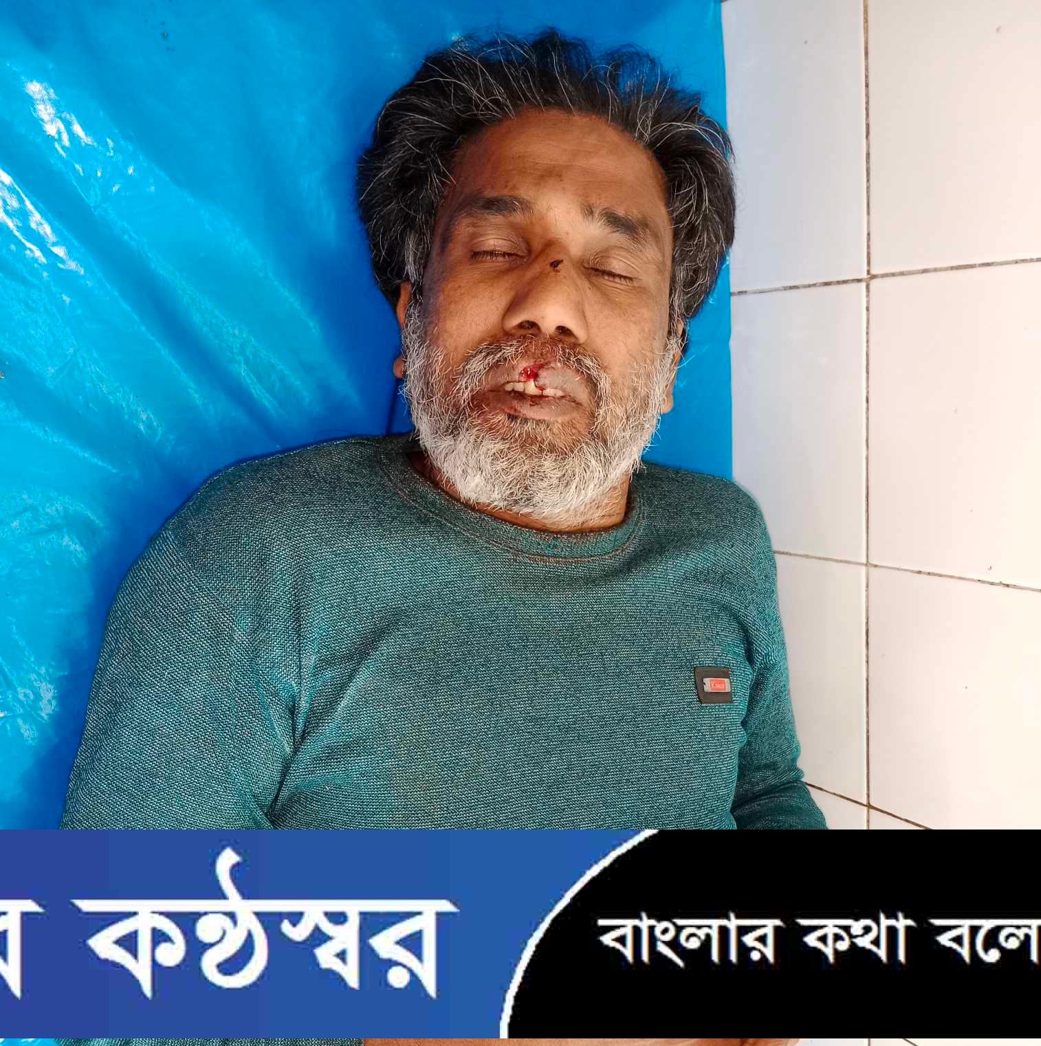 মির্জাগঞ্জে পূর্ব শত্রুতার জের ধরে শ্রমিককে কুপিয়ে জখমের অভিযোগ।