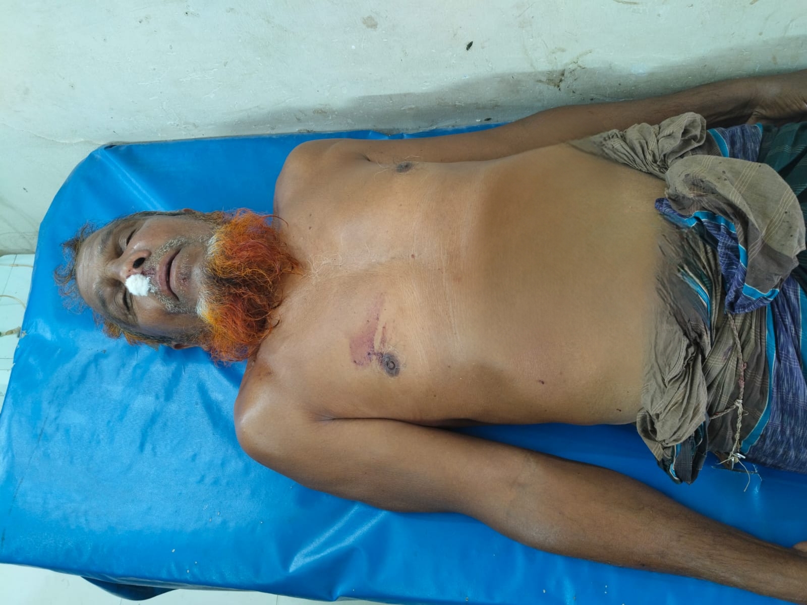 আগৈলঝাড়ায় পূর্ব বিরোধের জেরে হামলা, বাবা-ছেলে আহত