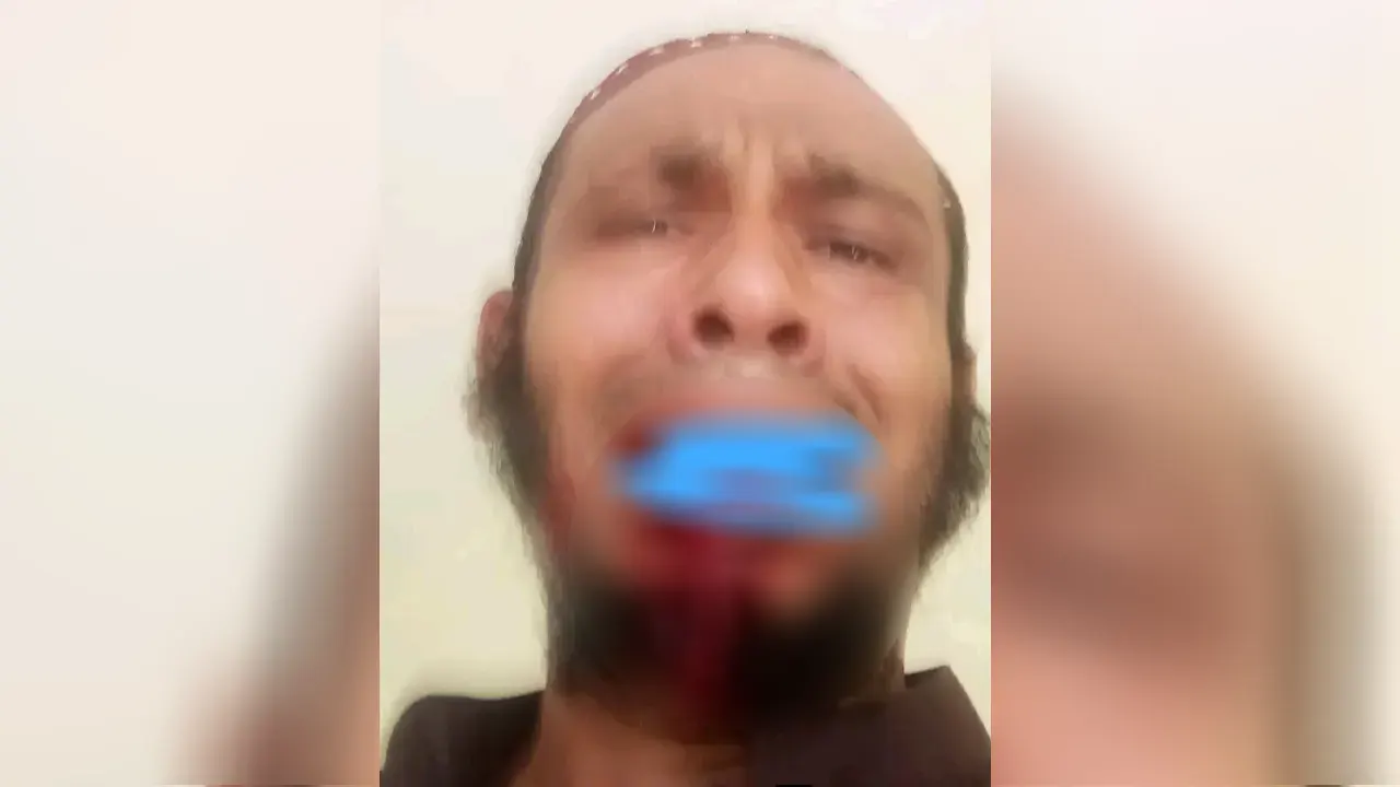 অধ্যক্ষের ঘুসিতে দাঁত ভাঙল কম্পিউটার অপারেটরের