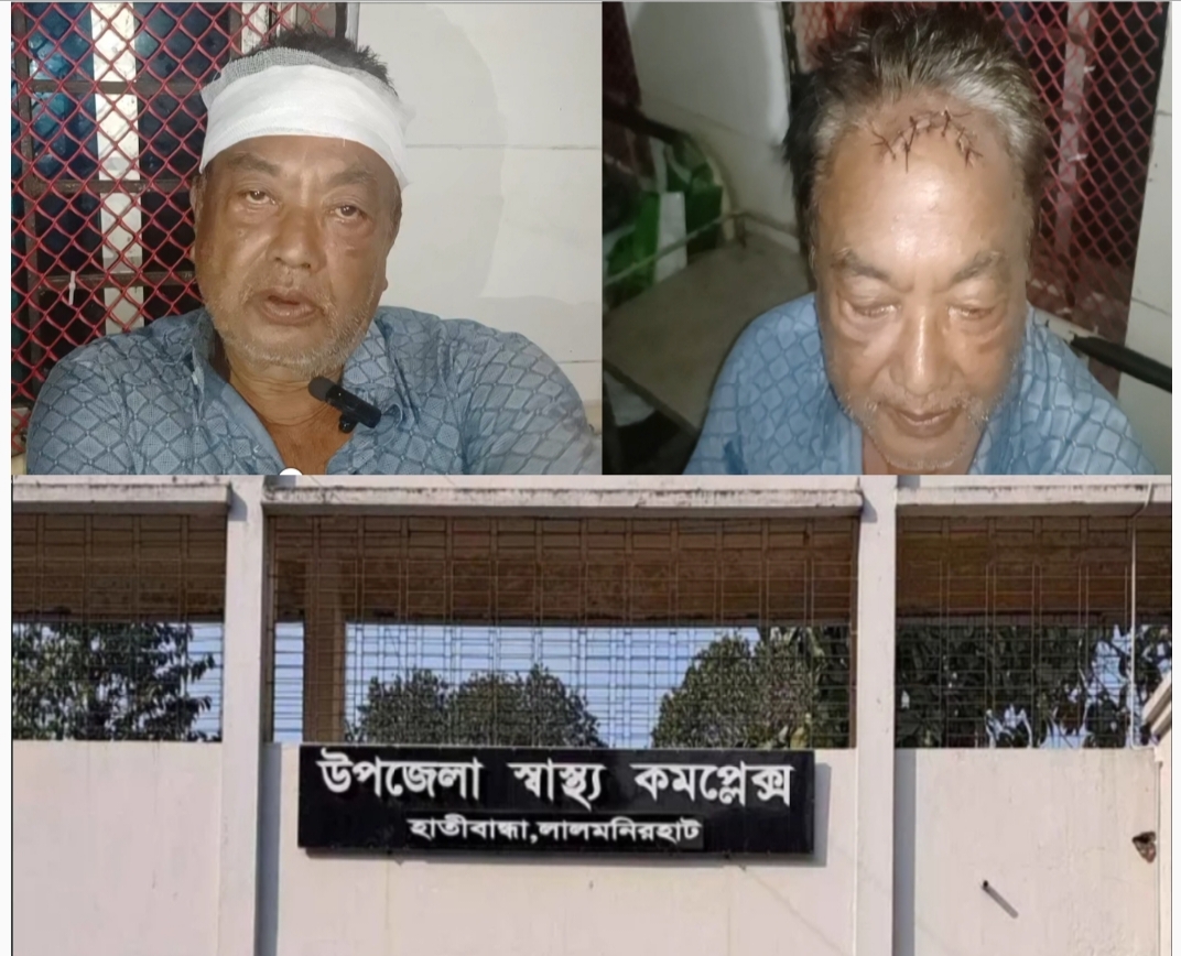 হাতীবান্ধায় বড় ভাইকে কুপিয়ে হত্যার চেষ্টা, থানায় অভিযোগ দায়ের।