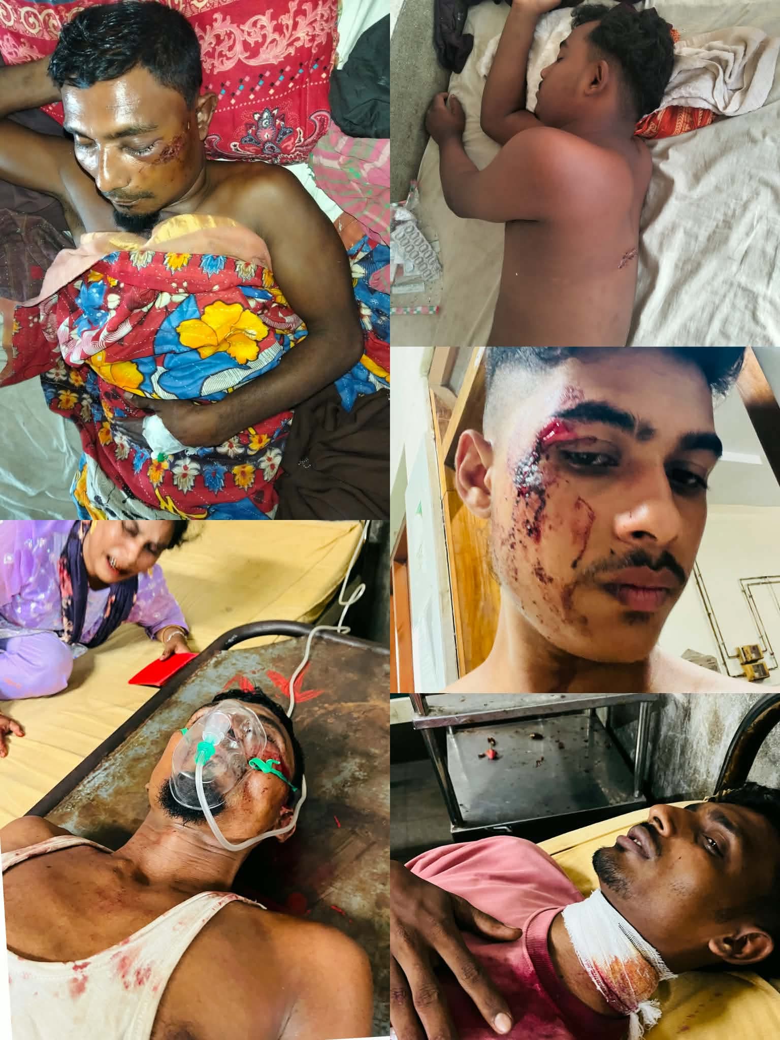 চরামদ্দিতে একই পরিবারের ৫ জনকে কুপিয়ে জখম