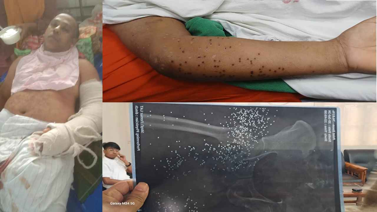 মৃত ভেবে ড্রেনের পাশে ফেলে রাখা হয়েছিল আমাকে