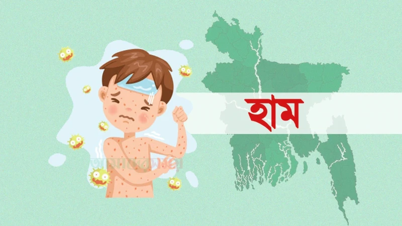 হাম ও উপসর্গে আরও ৪ মৃত্যু